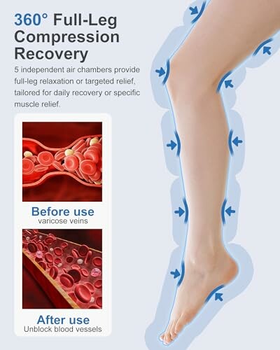 Diagram showing full-leg compression recovery with before and after effects on blood vessels.
